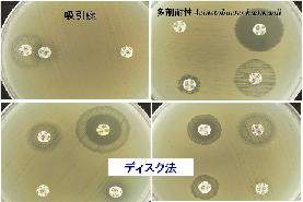 感受性-１