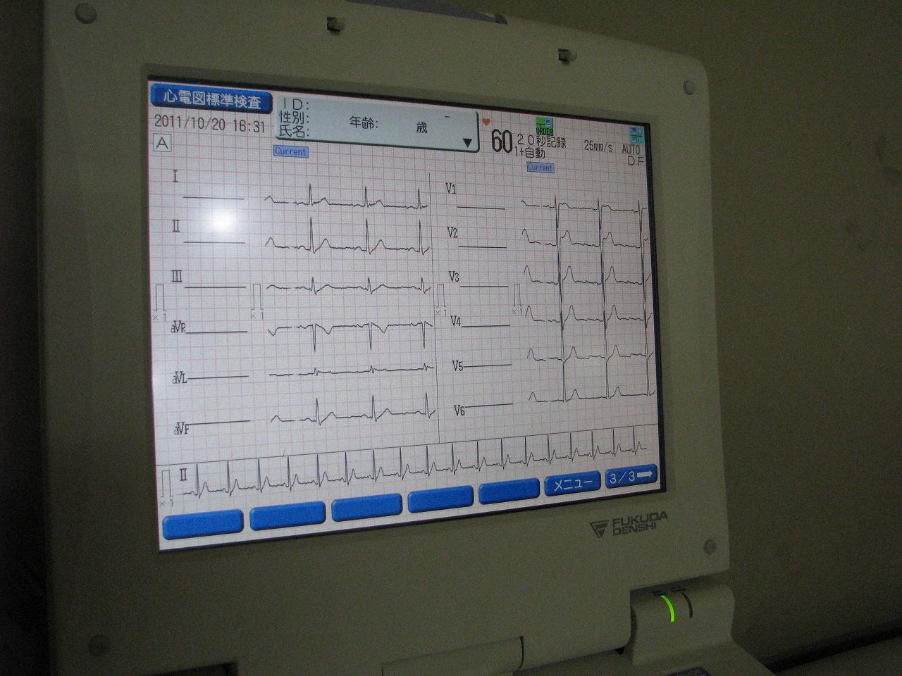12誘導心電図